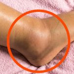 If you notice your legs are swollen, that’s a sign of ca…